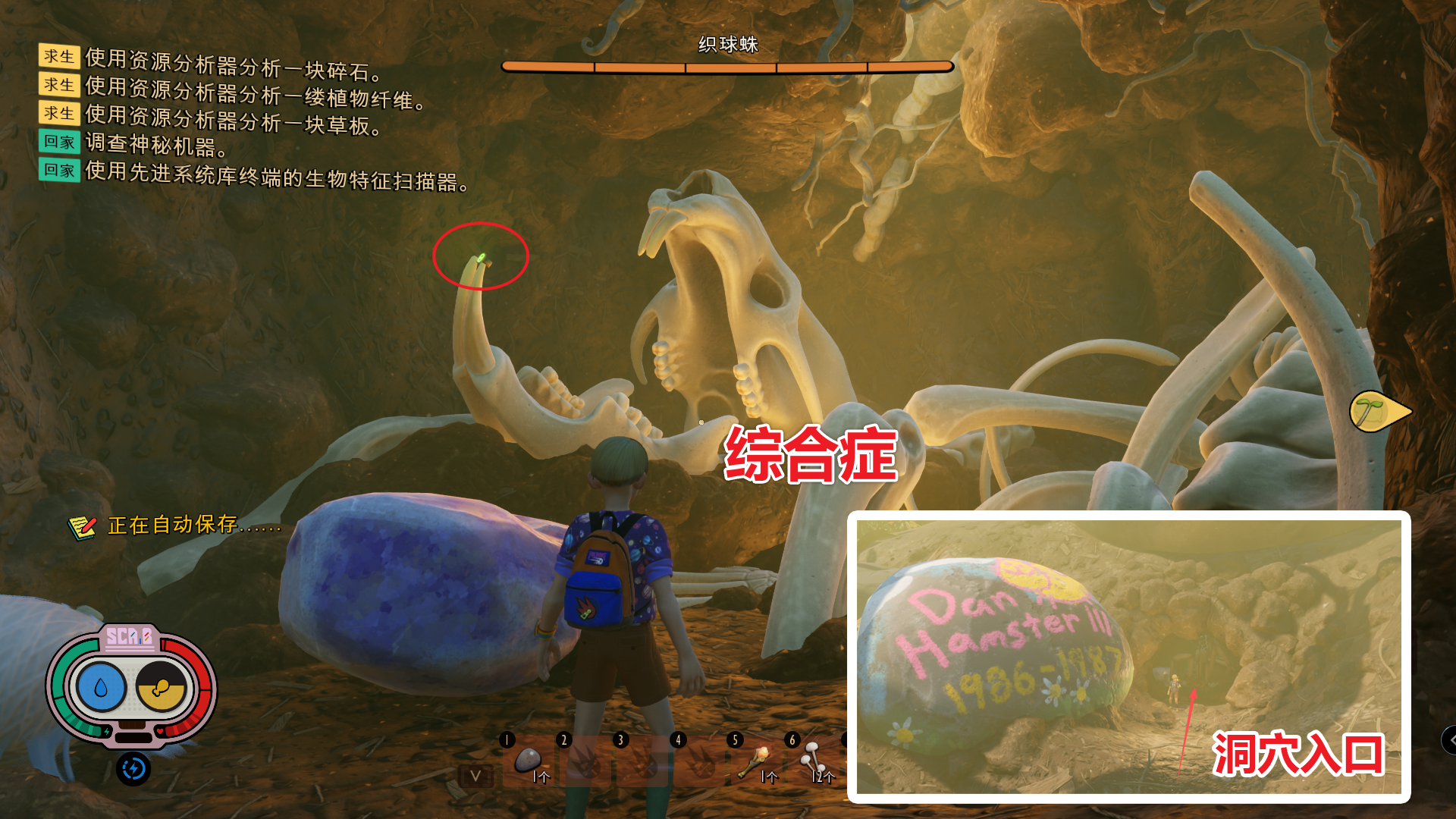 综合症 图解.png