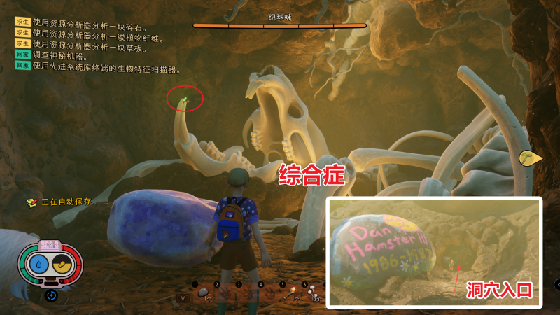 文件:综合症 图解.png