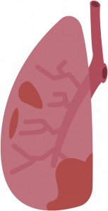 Lung.png