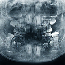 多生牙 调查归档.png